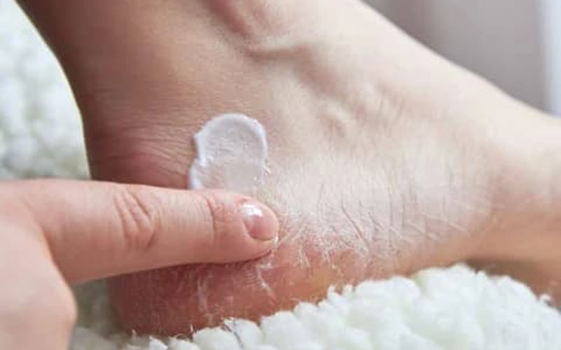 مراقبت از پوست کف پا در فصل پاییز