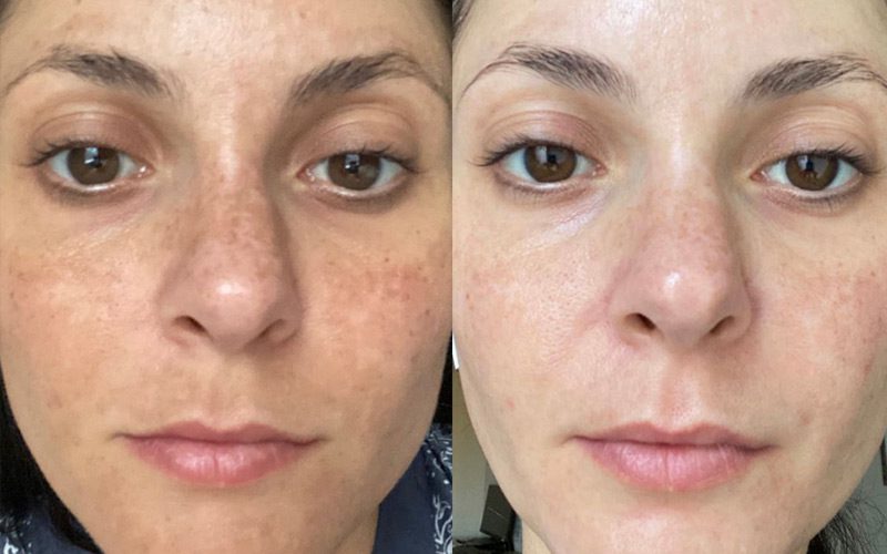 مزایای پاکسازی صورت چیست؟
