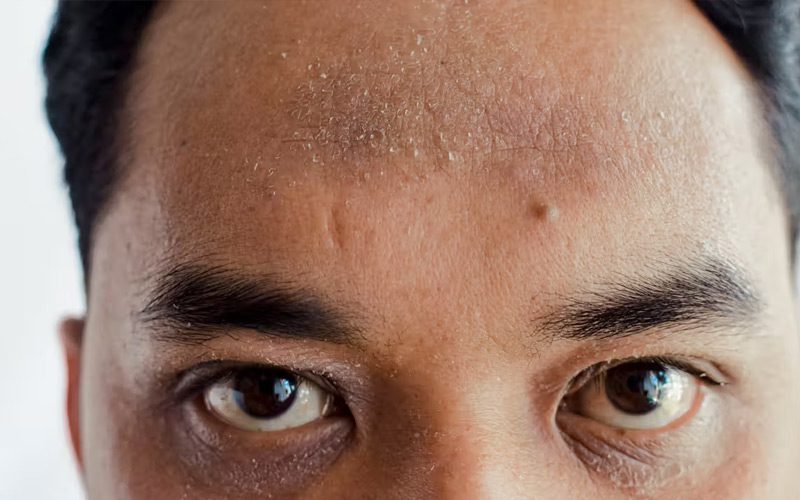 چه زمانی پوست صورت نیاز به پاکسازی دارد؟