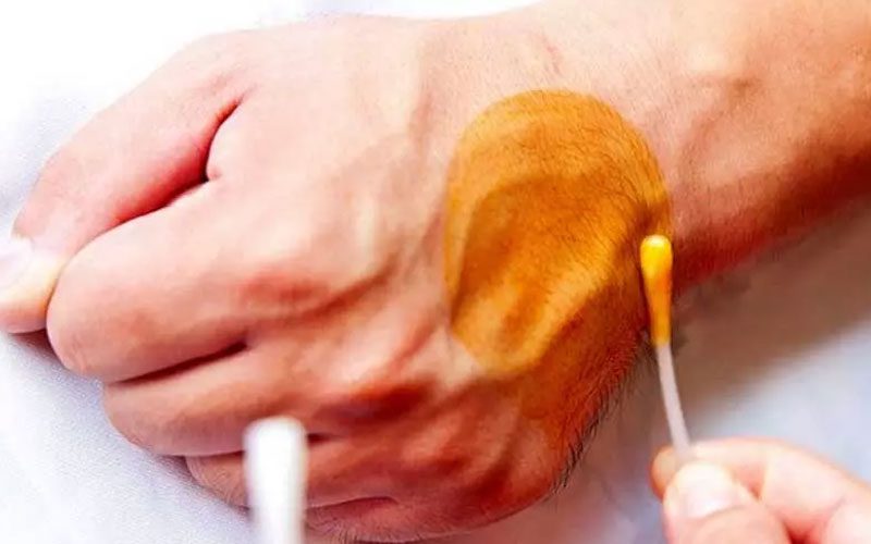 پوویدون آیداین یا بتادین