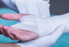 بهترین محلول ضدعفونی کننده زخم؛ راهنمای جامع انتخاب مناسب