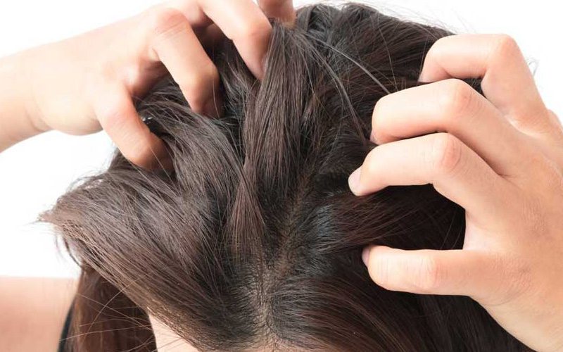 خشکی پوست سر چیست؟