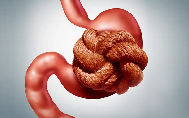 علل ابتلا به معده درد عصبی