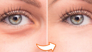 کاهش پف زیر چشم