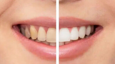 بهترین خمیر دندان سفید کننده